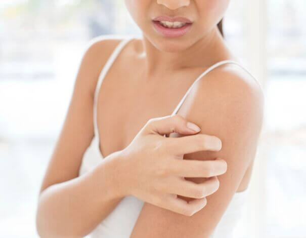 Woman scratching her arm skin
